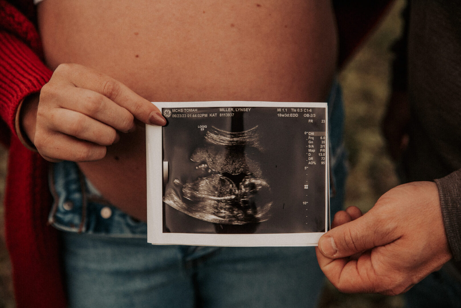 A person holding an ultrasound picture in their hand.